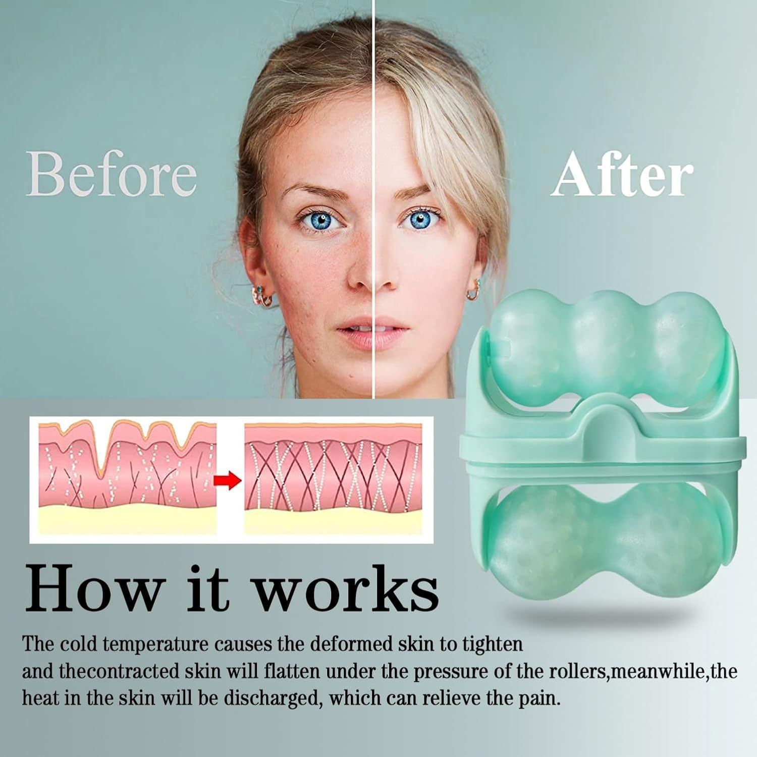 2 in 1 Ice Roller