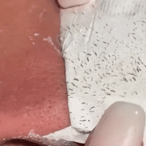 Lanbena Nose Pore Strips