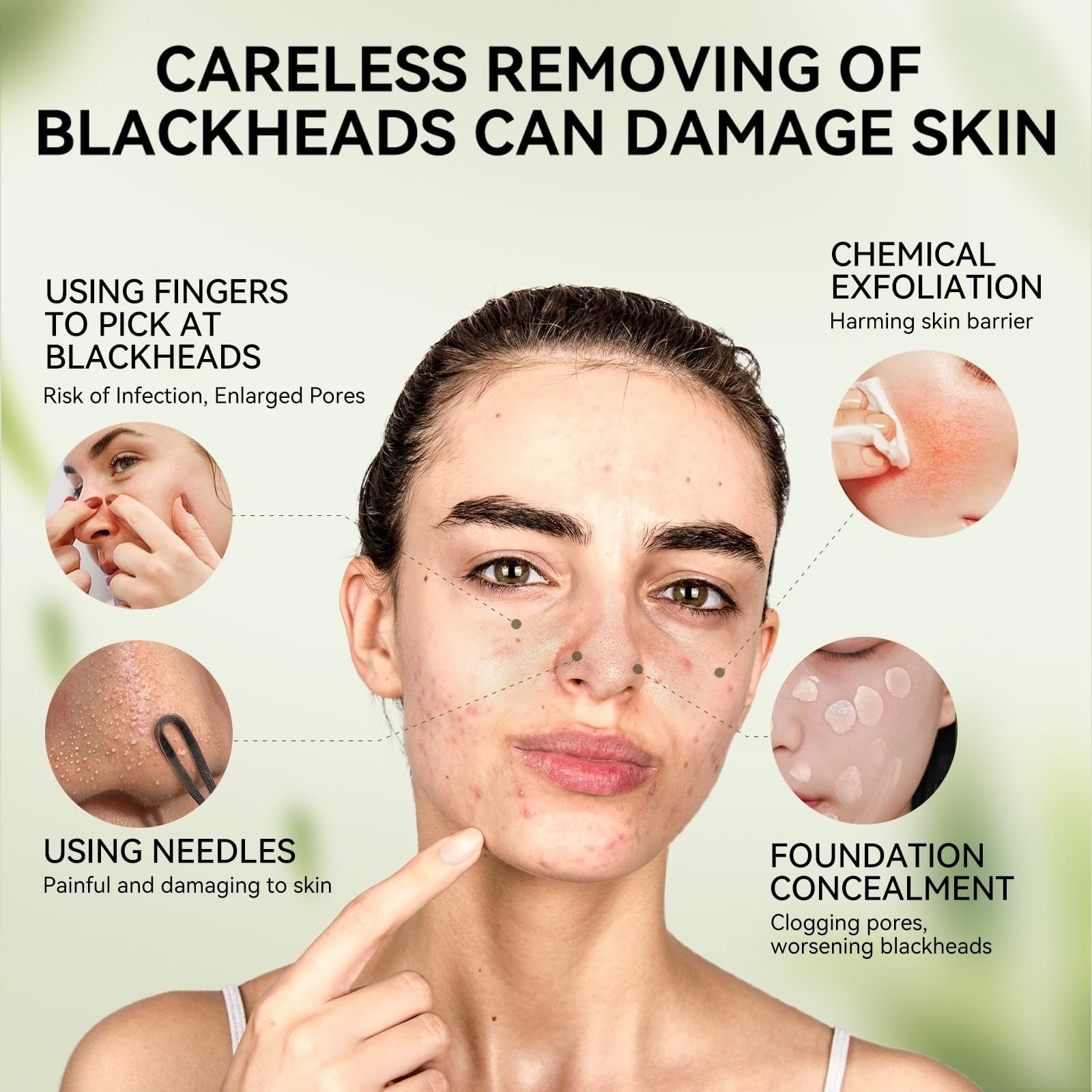 Lanbena Nose Pore Strips