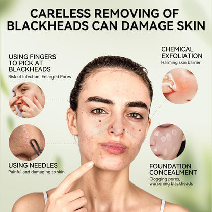Lanbena Nose Pore Strips
