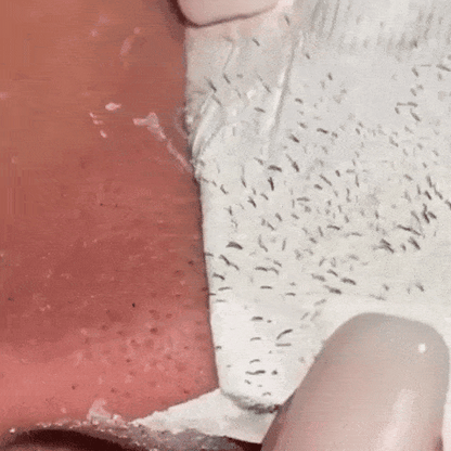 Lanbena Nose Pore Strips